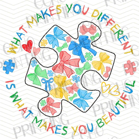 ATMSG 216 – DIFFERENCES MAKE YOU SPECIAL